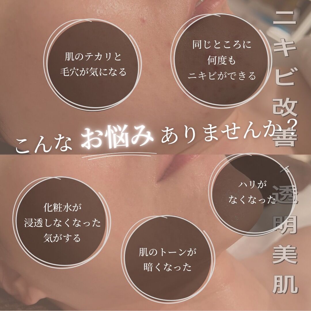 マーメイドセルトリートメントの魔法『ONFREEKで叶える美の再発見』