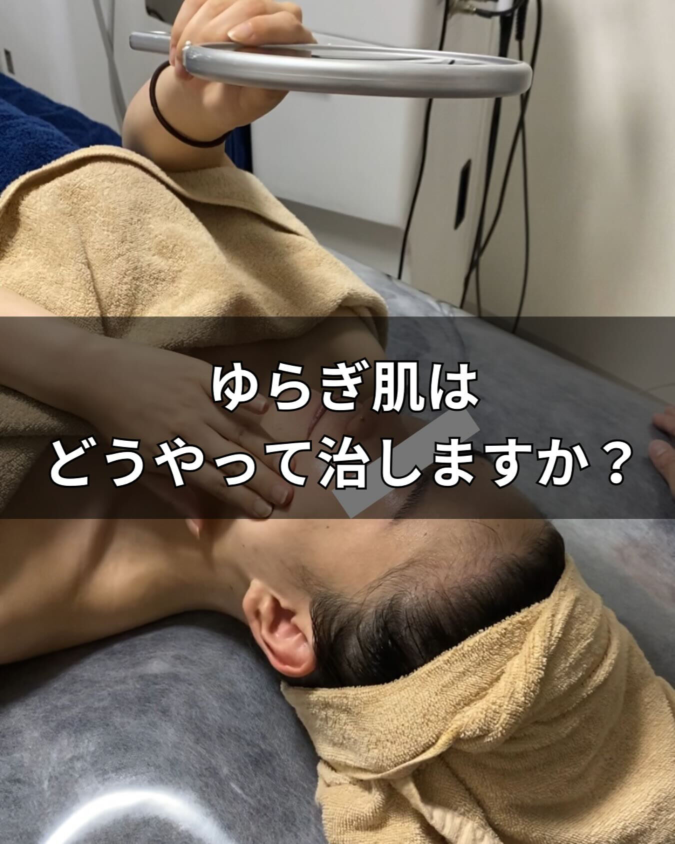 ゆらぎ肌とは？まずは治すべき理由を把握