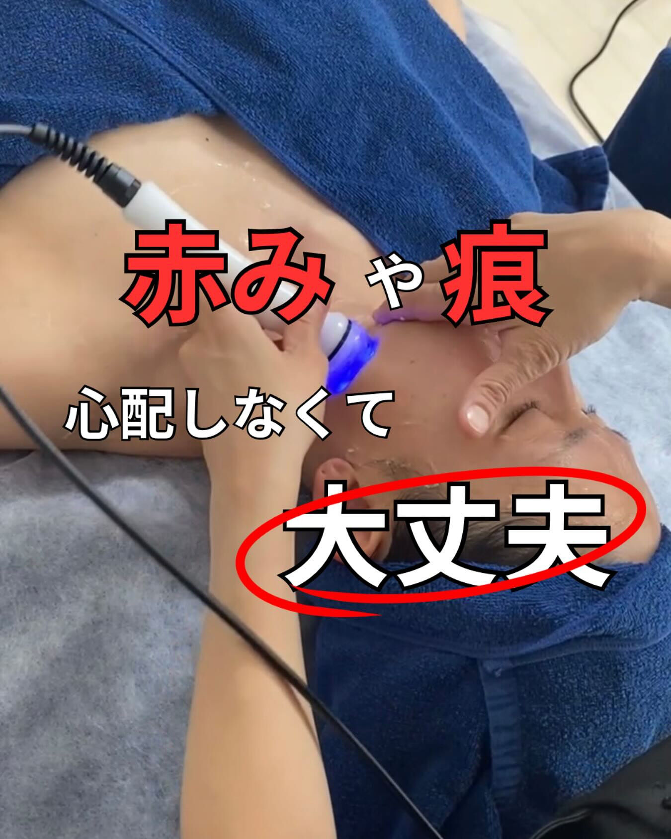 ハイパーナイフは痕が残りますか？