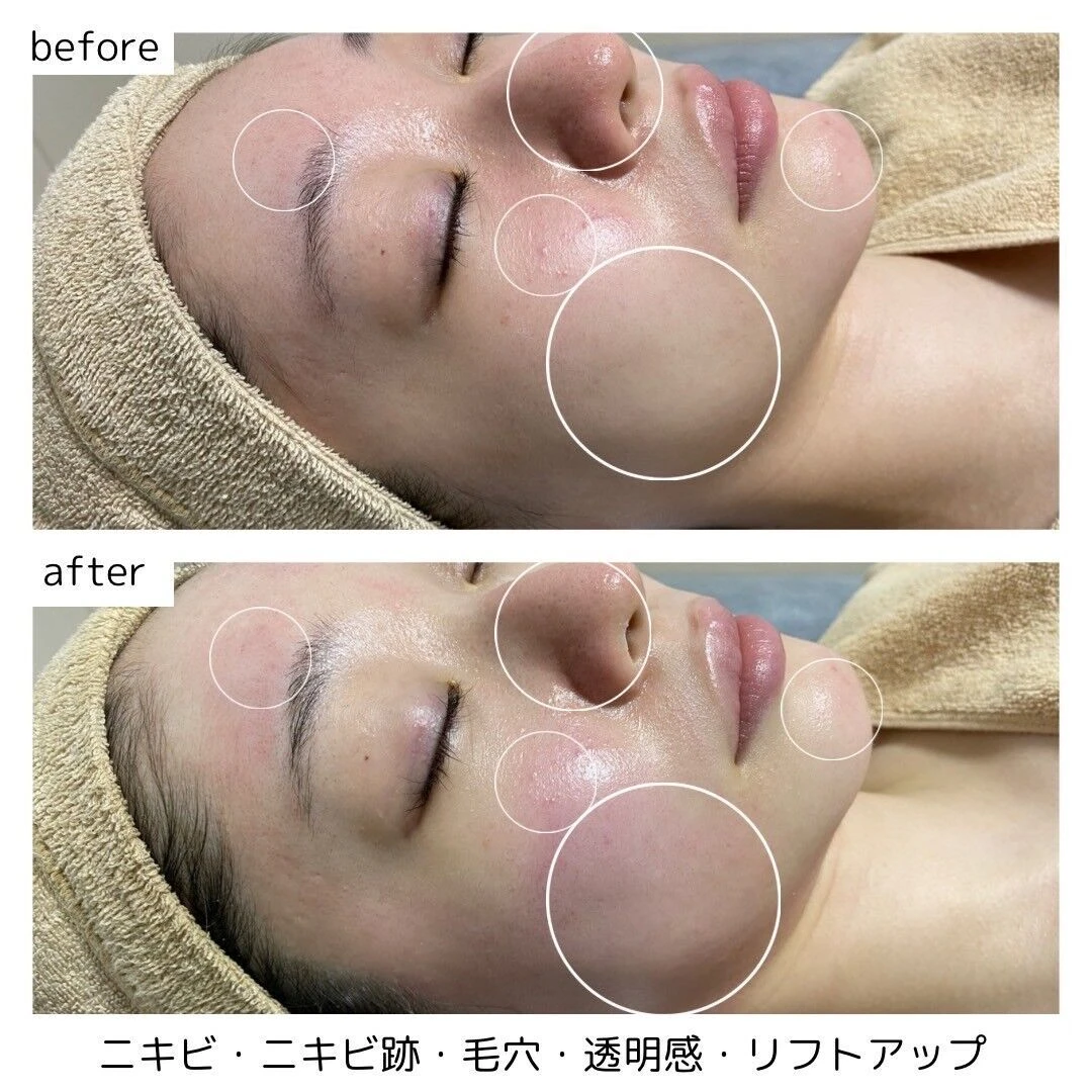 ブログ