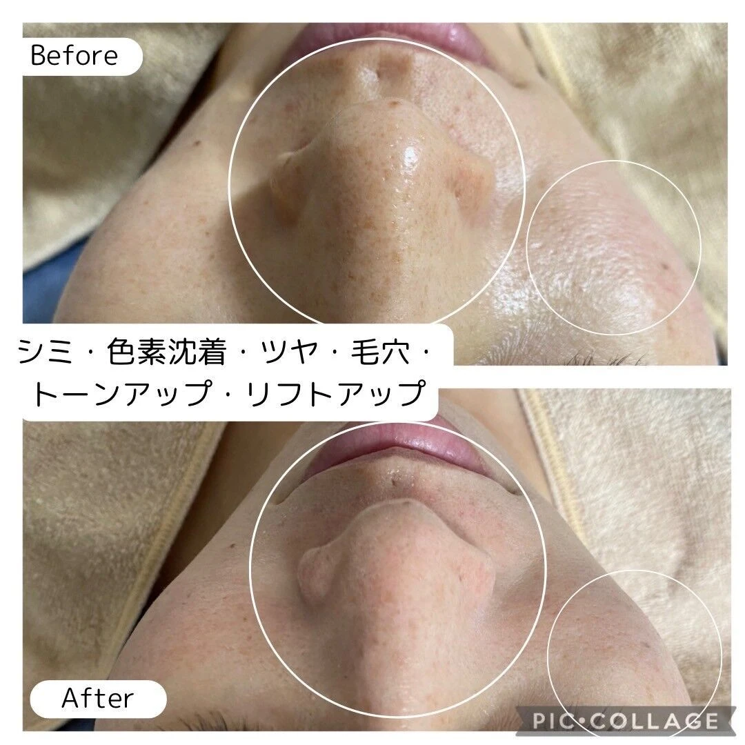 LINE_ALBUM_投稿用ビフォアフ画像_241119_3.jp