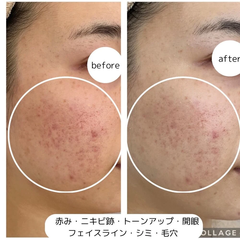 画像3894