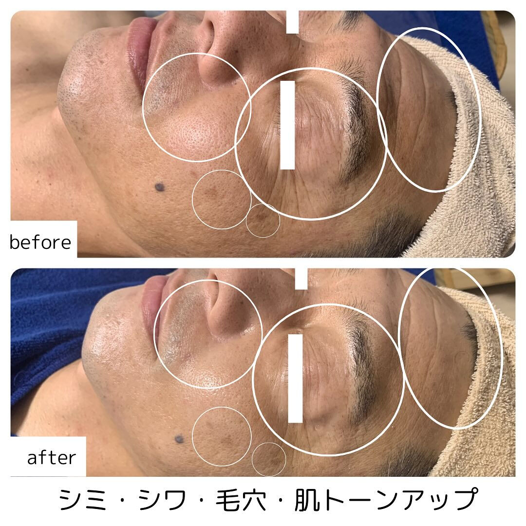 メンズエステにはどんな効果があるのですか？