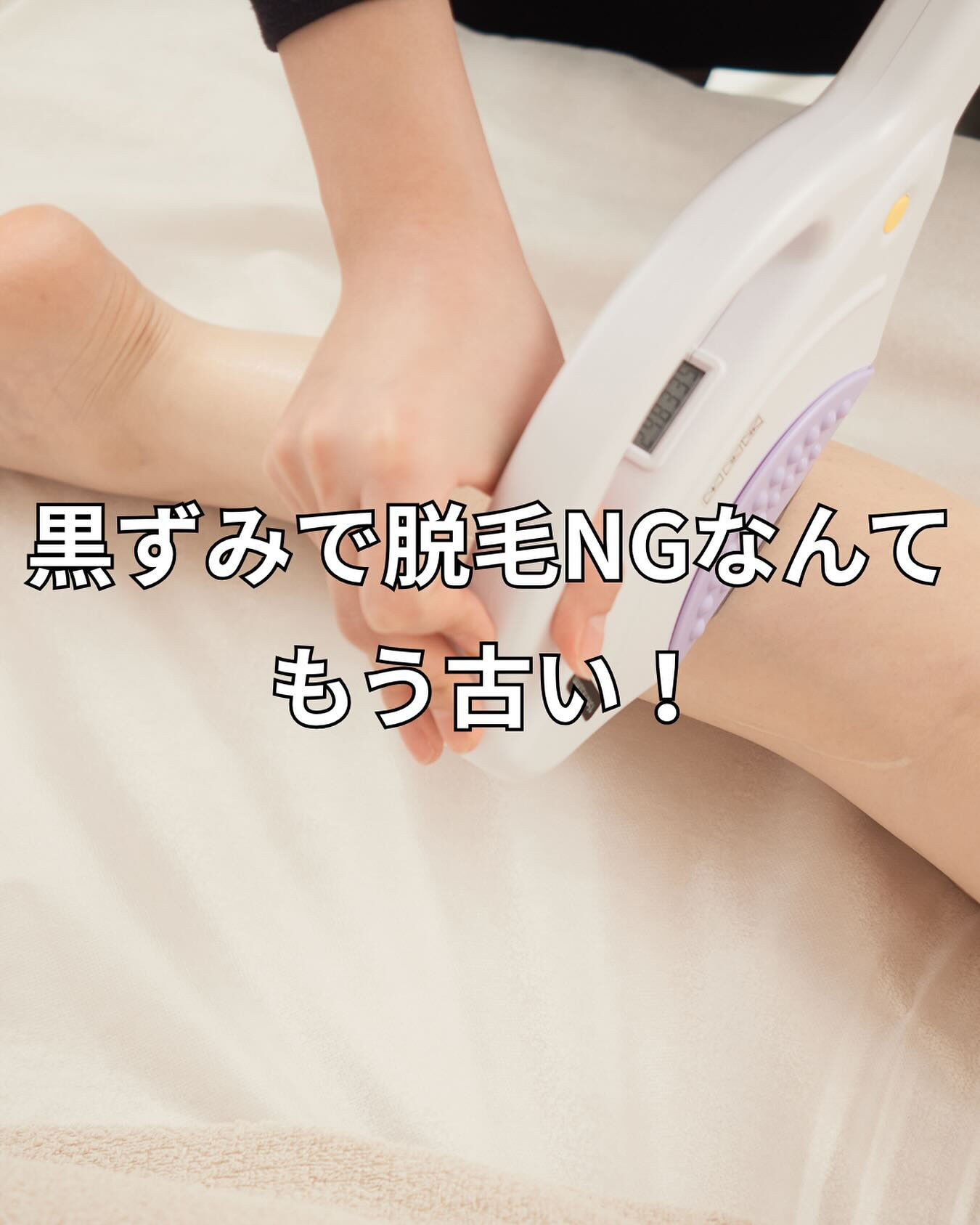 SHR脱毛は黒ずみがあってもできますか？
