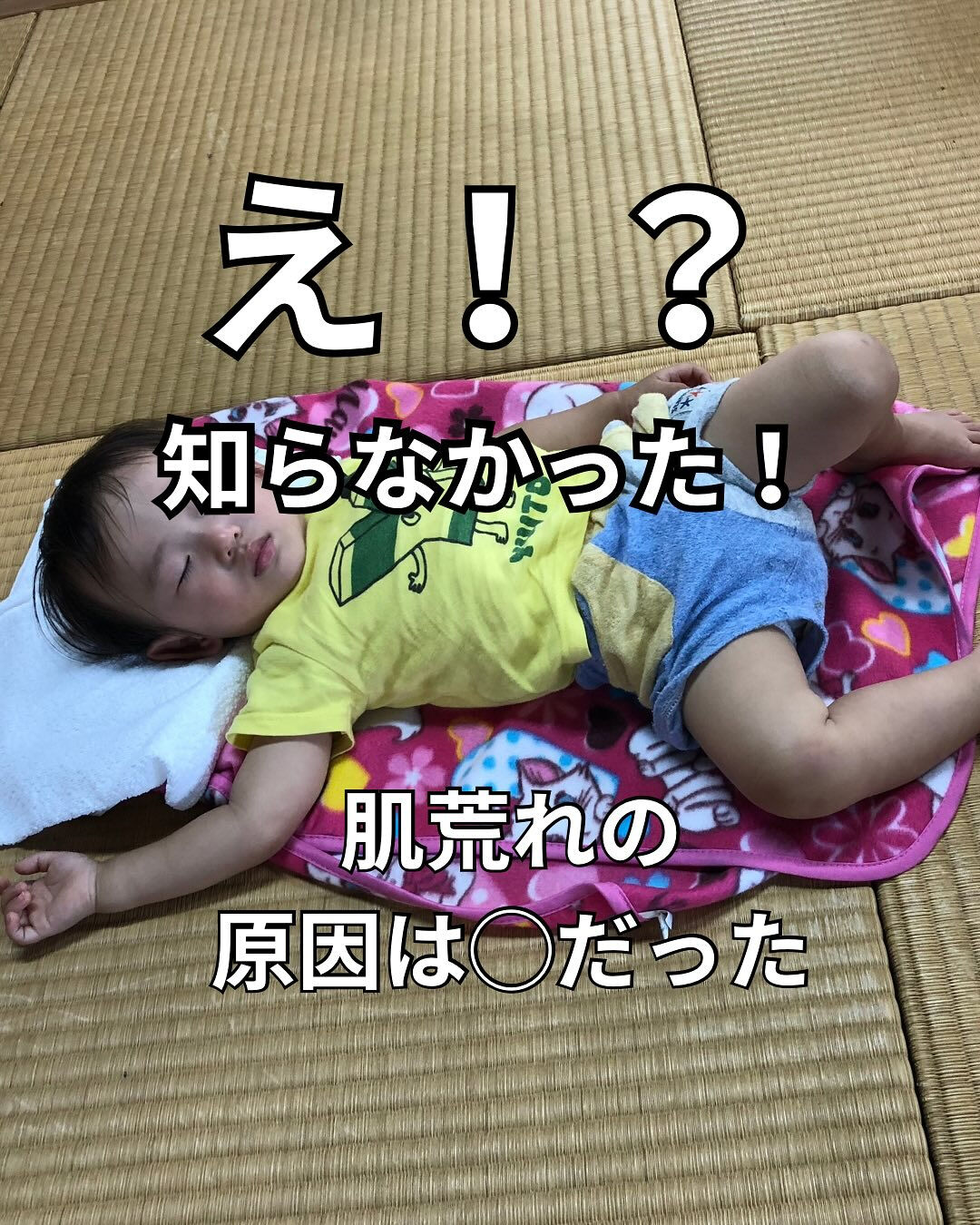 「朝起きたら、なんか肌がごわつく…🥲」