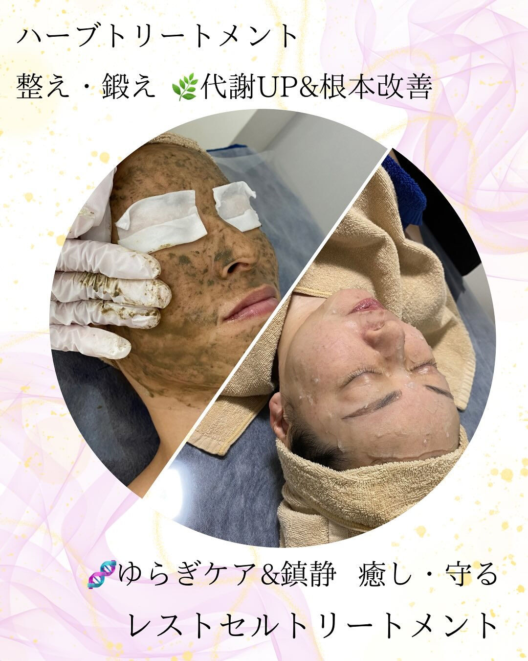 6月に肌荒れするのはなぜ？