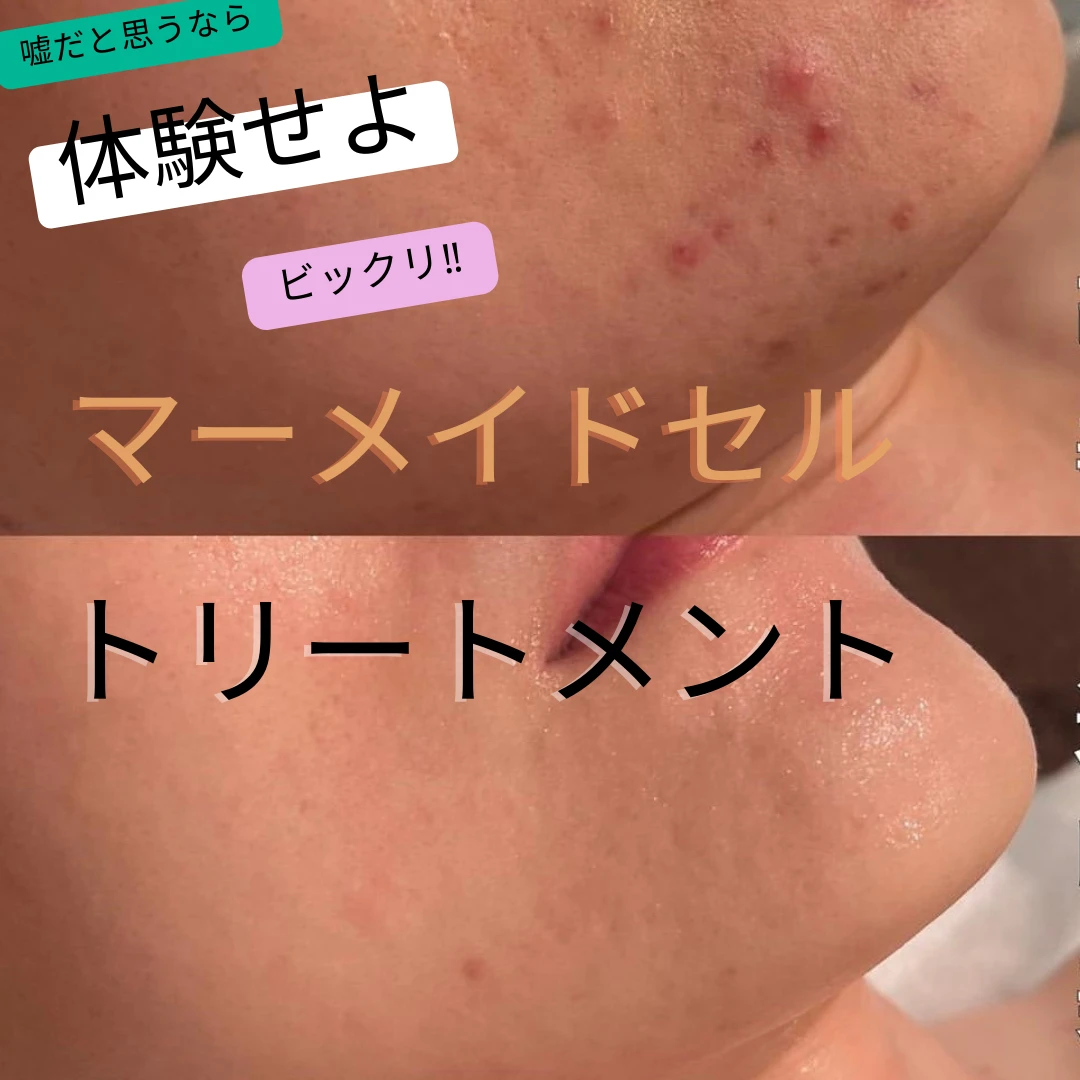 ベージュ スキンケア 美容 肌の悩み Instagram 投稿 正方形 広告 バナー - 2.pn